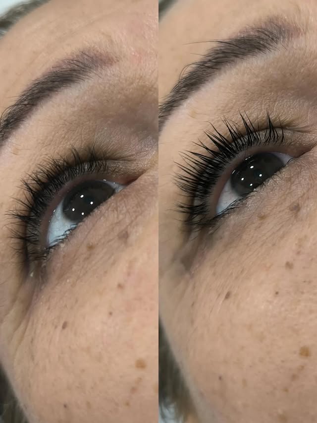 Trabajo de estetica 11