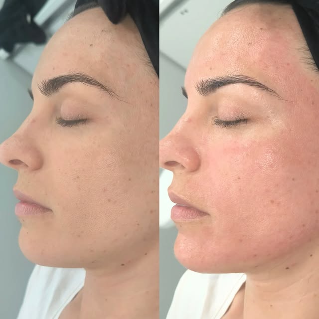 Trabajo de estetica 7
