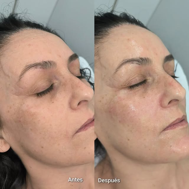Trabajo de estetica 9